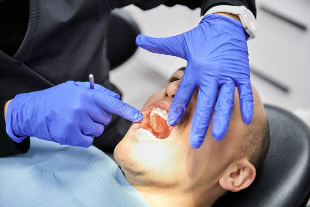 Best Dentist for Severe Toothache  in Ellis, KS